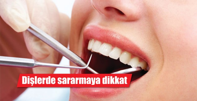 Uzmanlar, dişlerde oluşan sararmalara dikkat edilmesi konusunda uyarılarda bulundu. 
