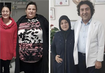 Yozgat’ta aynı aileden iki kardeş, mide küçültme ameliyatı ile fazla