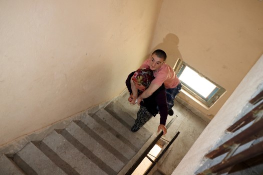 Yerköy ilçesinde ailesiyle birlikte yaşayan osteomiyelit (kemik iltihabı) hastalığı nedeniyle