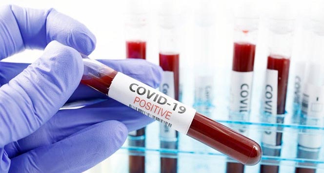 İçişleri Bakanlığı, 81 il Valiliğine “Temaslıların doğru bilgilendirilmesi” konulu genelge