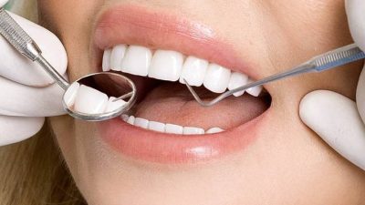 Yozgat Ağız ve Diş Sağlığı Merkezi’nde diş dolgusu yaptıran bazı