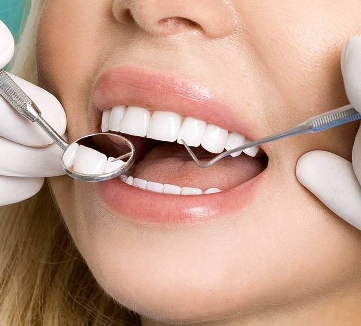 Yozgat Ağız ve Diş Sağlığı Merkezi’nde diş dolgusu yaptıran bazı