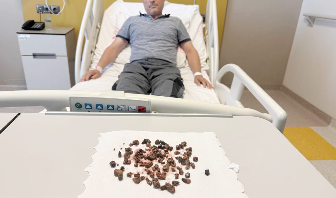 Yozgat Şehir Hastanesinde gerçekleştirilen başarılı bir ameliyatta, 45 yaşındaki Serhat