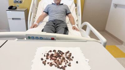 Yozgat Şehir Hastanesinde gerçekleştirilen başarılı bir ameliyatta, 45 yaşındaki Serhat