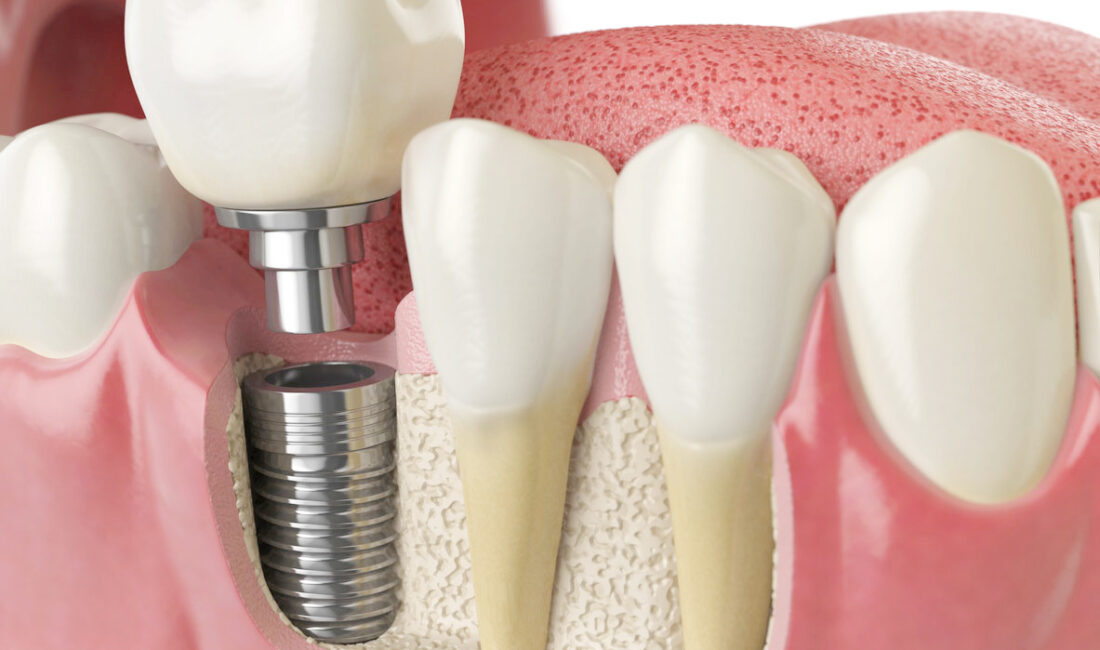 MHP Genel Başkan Yardımcısı ve Kayseri Milletvekili İsmail Özdemir, milyonlarca