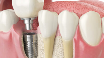 MHP Genel Başkan Yardımcısı ve Kayseri Milletvekili İsmail Özdemir, milyonlarca